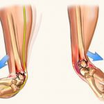 Εκπαιδευτικά μαθήματα Φυσικοθεραπείας